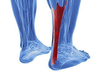 achilles tendon