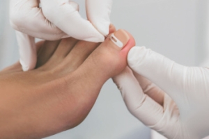 How to Prevent Ingrown Toenails